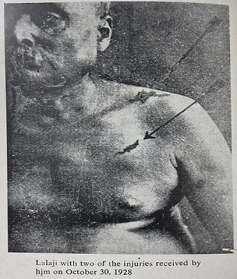Lala Lajpat Rai